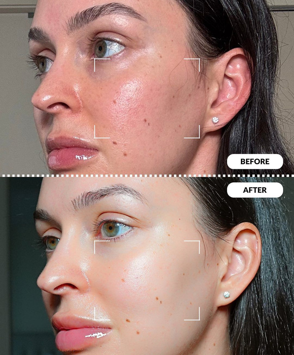 Lovvish Korean Collagen Mask™