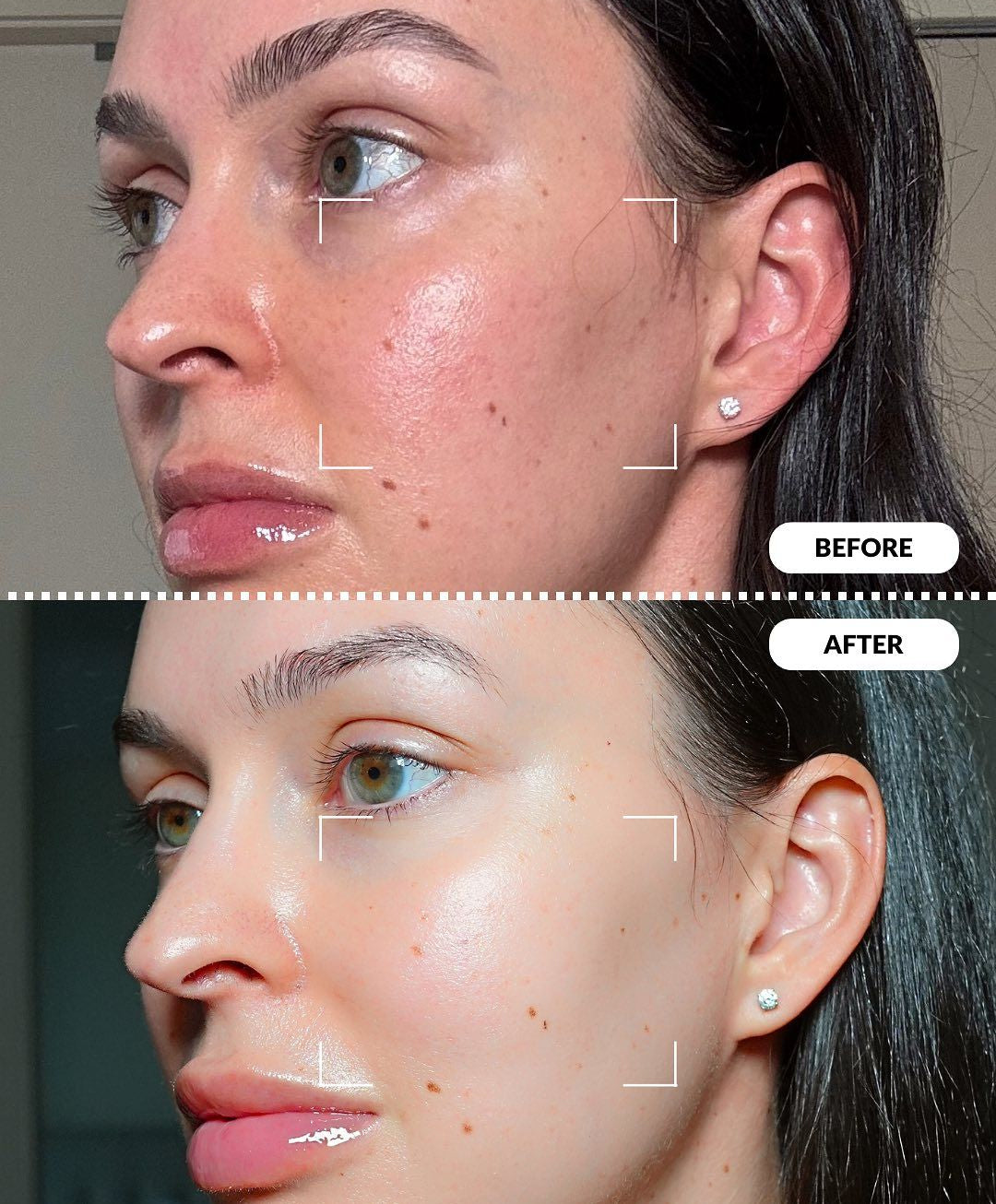 Lovvish Korean Collagen Mask™
