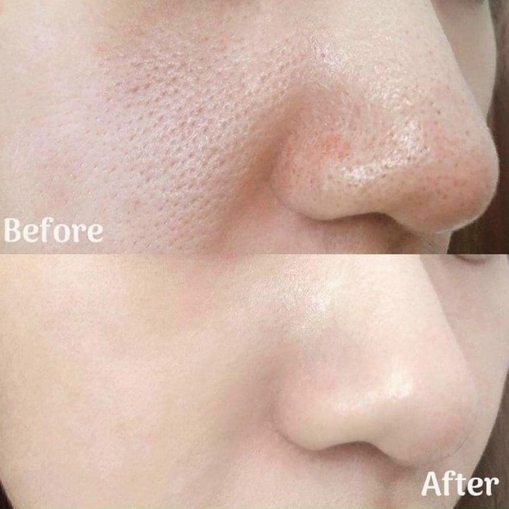 Lovvish Korean Collagen Mask™